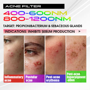 Appareil professionnel de raffermissement cutané au laser BBL, 8 filtres, dispositif de lifting du visage, anti-âge, élimination des rides, 4 têtes - Product Image 6