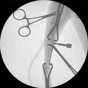 آلة تنظير الذراع PFD C لجراحة الأشعة مع نظام ذراع رقمي C جهاز أشعة <span class=keywords><strong>X</strong></span> - Product Image 2