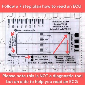 Règle <span class=keywords><strong>de</strong></span> mesure <span class=keywords><strong>ECG</strong></span> à 7 étapes pour l'interprétation, outil <span class=keywords><strong>de</strong></span> mesure en plastique transparent, rapporteur EKG, référence pour les infirmières - Product Image 2