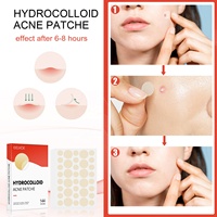 Nouveauté 2026 en stock : Patchs hydrocolloïdes OEM pour le traitement des boutons du nez et du visage – Solution maîtresse contre l'acné