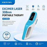 Lampe Excimer 308 nm pour le traitement du vitiligo – Photothérapie ciblée à domicile pour la peau