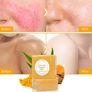 Savon au curcuma biologique éclaircissant au curcuma pour éliminer les taches brunes du visage contre l'acné - Product Image 5