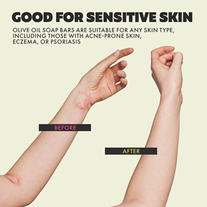 Savon en barre à l'<span class=keywords><strong>huile</strong></span> <span class=keywords><strong>d</strong></span>'<span class=keywords><strong>olive</strong></span> OEM ODM avec vitamines A et E et squalène - Nettoyant doux hydratant <span class=keywords><strong>pour</strong></span> peaux sensibles, acné, eczéma, <span class=keywords><strong>psoriasis</strong></span> - Product Image 5