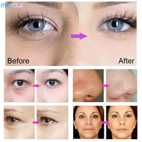 D Cool Piel portátil de alta calidad D Cool Electroporation Skin Cool Máquina facial fresca