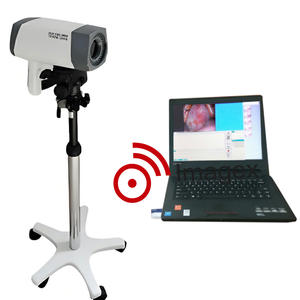 <span class=keywords><strong>Vaginoscope</strong></span> électronique numérique Colposcope vidéo pour examen gynécologique - Product Image 5