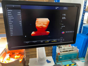 Sistem <span class=keywords><strong>Ultrasound</strong></span> Diagnostik 4D/3D Multi-Fungsi Mesin <span class=keywords><strong>Ultrasound</strong></span> Doppler Warna 4D dengan Layar Sentuh - Product Image 4