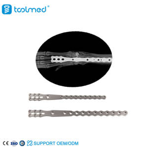 การปลูกถ่ายข้อต่อข้ออักเสบชนิดตรงของแผ่นล็อคข้อต่อข้อเข่าไทเทเนี่ยม - Product Image 5