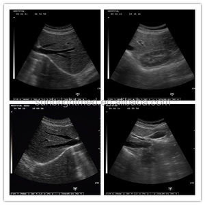 Pemindai <span class=keywords><strong>Ultrasound</strong></span> hewan rumah sakit portabel, pemindai Laptop 12.1 "untuk kehamilan hewan peliharaan portabel - Product Image 6