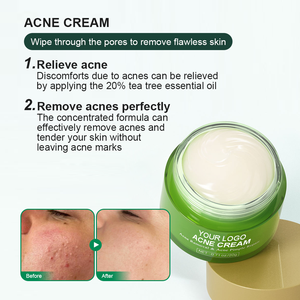 Crème <span class=keywords><strong>de</strong></span> traitement <span class=keywords><strong>de</strong></span> l'acné acide salicylique huile <span class=keywords><strong>d</strong></span>'arbre à thé à base <span class=keywords><strong>de</strong></span> glycérine pour le visage contrôle <span class=keywords><strong>de</strong></span> l'huile corporelle soulagement des imperfections Service OEM/ODM - Product Image 3