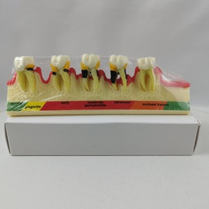 Modèle dentaire de classification parodontale M4010, modèle anatomique en silicone médical pour l'enseignement dentaire - Product Image 1