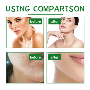 <span class=keywords><strong>Gommage</strong></span> à l'aloe vera pour un nettoyage en profondeur exfoliant éclaircit les marques d'acné adoucit la <span class=keywords><strong>peau</strong></span> - Product Image 4