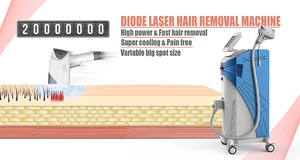 SopranoINGS Ice <span class=keywords><strong>Titanium</strong></span> Portable 808 Depilación Láser de Diodo ALMAINGS 755nm 808nm 1064nm máquina de depilación láser de diodo - Product Image 6