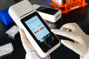 Analisador de Química Sanguínea Veterinário Analisador de Gases Sanguíneos e Eletrólitos Analisador de Gases Sanguíneos para Cuidados Intensivos - Product Image 3