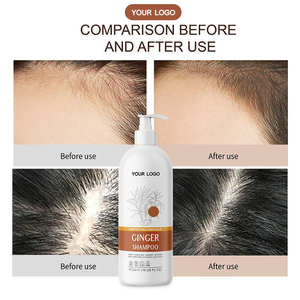 Strengthening Nourishing Scalp Care Treatment Thinning Weak Hair Improving Root Vitality Biotin Ginger Anti Hair Loss <b>Shampoo</b> - Product Image 2