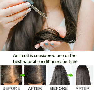 Óleo de <span class=keywords><strong>Amla</strong></span> para Cuidado do Couro Cabeludo ALIVER 60ml Óleo Indiano para Crescimento Capilar - Product Image 4