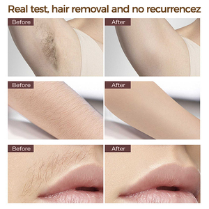 Depiladora de Alta Energía 28j con Reconocimiento del Color de la Piel, Depiladora Láser para Bikini, Depiladora Láser IPL con Enfriamiento para Mujer - Product Image 6