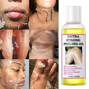 OEM Extra forza Peeling olio giallo vitamina C & crema idratante sbiancante per rimozione macchie scure olio essenziale puro