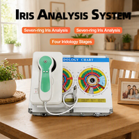 Kit complet de caméra d'iridologie USB, avec base de support, câble USB, objectif, CD logiciel, prise en charge de la capture et de l'impression d'un rapport d'analyse, analyse corporelle