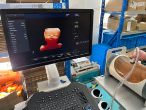 Échographe médical portable 4D 3D 2D, chariot, échographe couleur Doppler, scanner d'échographie diagnostique - Product Image 2