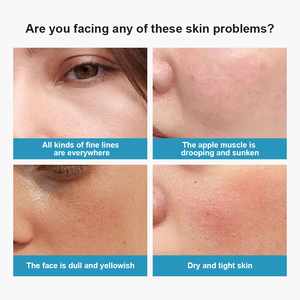 Crema OEM ODM con Extracto de Vitamina E, Reparación <span class=keywords><strong>SOS</strong></span> de Barrera para Todo Tipo de Piel, Humectante Facial Herbal con Ingredientes de Ácido Hialurónico - Product Image 3