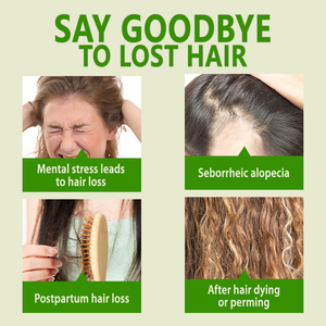 Aceite de Ricino Negro 100% Puro Prensado en Frío al por Mayor, Aceite de Ricino Orgánico de Nutrición Profunda para el Cabello, Apto para Todo Tipo de Cabello, para el Cuidado Capilar - Product Image 5