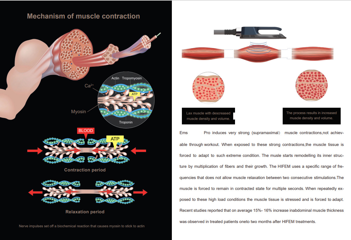 RF Emslim Neo Muscle Stimulator Machine Electromagnetic Shockwave Body Sculpt