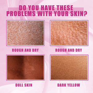 <span class=keywords><strong>2026</strong></span> <span class=keywords><strong>Vitamin</strong></span> <span class=keywords><strong>C</strong></span> Peeling Yağı Koyu Ten Sarı Ten Nemlendirici Pürüzsüzleştirici Eklem Bakımı Koyu Leke Giderici Vücut Bakım Yağı - Product Image 6