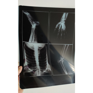 fuji xray film for Hospitals Ready To Ship Within 15 Days