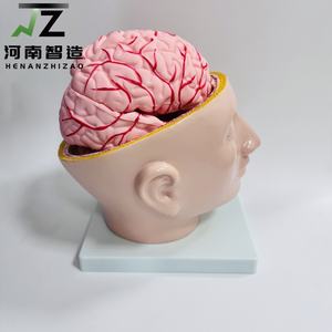 Modelo Anatómico de las Arterias Cerebrales en Relación con la Cabeza Humana - Modelo de Enseñanza y Entrenamiento Médico - Product Image 4
