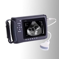 Scanner à ultrasons portable numérique pour la maison pour le test de grossesse de la vache