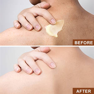 Crème de Karité Brute Non Raffinée Marque Blanche OEM Vente en Gros Beurre de Karité Biologique Pur pour Produits Hydratants Visage et Cheveux - Product Image 5