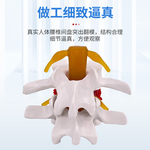 Simulation pédagogique du modèle de hernie discale lombaire humaine, démonstration de mesure de la pression vertébrale, vertébral - Product Image 3