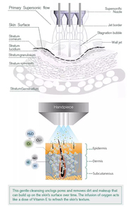 Dispositivo de Cuidado de la Piel Jet Peel de Grado Comercial con Flujo de Gotas Moleculares de 5-20um, Estimulación de Colágeno, Reducción de Arrugas e Hidratación - Product Image 2