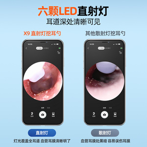 Kit de Herramientas Endoscópicas de Alta Definición X9, Palillo Inteligente para Limpieza Visual de Oídos para Adultos, Limpiador de Oídos Inalámbrico para Canal Auditivo, Removedor de Cera - Product Image 5