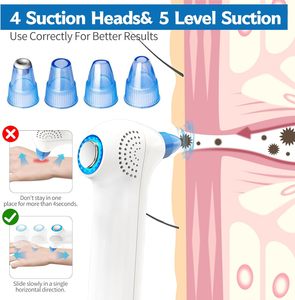 Nhà Máy Giá chân không mụn đầu đen Remover lỗ chân lông sạch hơn điện Comedo extractor sâu làm sạch mặt thiết bị chăm sóc sử dụng nhà - Product Image 3