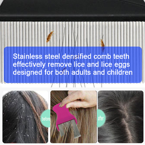 Chất lượng cao giá thấp thoải mái Grip không có biến dạng Fine-tooth lược cho Chí cho gàu loại bỏ Terminator Chí Lược - Product Image 5