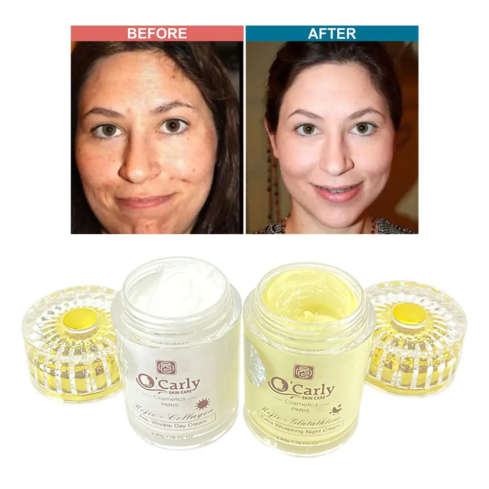 RT Bayuan O'Carly Creme facial diurno e noturno com Kojic & Glutathio Colágeno Anti-rugas Produtos de cuidados com a pele extra branqueadores