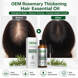 Custom Logo Rosemary Scalp Massage Oil With Vitamin E And Grapeseed Oil For Hair Root Support And Daily Nourishment - Product Image 5