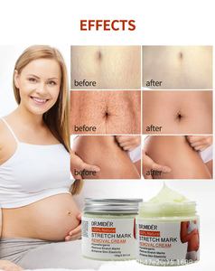 Crema Corporal Herbal 100% Pura de Fórmula Exclusiva de Marca Privada, Mejora la Elasticidad de la Piel, Antiarrugas, Repara Quemaduras/Estrías Quirúrgicas - Product Image 2