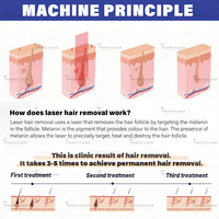 Perfectlaser Professionnel 1200W 1600W Double Poignée Têtes Magnétiques de Traitement Refroidissement Glacé Machine d'Épilation à Diode pour Salon