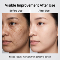 OEM ODM Essence de soin du visage nettoyante, hydratante, blanchissante, anti-âge et anti-rides quotidienne à base de Niacinamide et d'Acide Hyaluronique naturels
