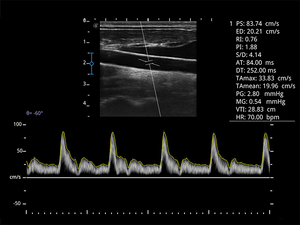 Escáner de Ultrasonido Veterinario <span class=keywords><strong>Sonoscape</strong></span> E1V <span class=keywords><strong>E1</strong></span> y Ultrasonido en Blanco y Negro para Uso Veterinario y Venta para Clínicas y Hospitales de Mascotas - Product Image 3