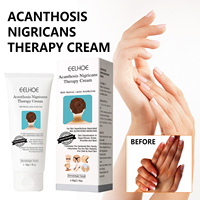 Crème réparatrice pour l'épiderme noir - Répare les taches sombres sur les aisselles, les bras et les genoux, hydrate et éclaircit la peau, ODM/OEM