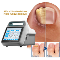 Sunrise Endo Lifting 980nm et 1470nm 50W Traitement efficace de l'onychomycose (mycose des ongles) Autres produits de beauté et de soins personnels