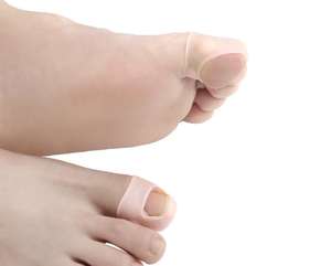 Dispositif de pédicure invisible en silicone (1 paire) pour prévenir et corriger les ongles incarnés et les paronychies - Product Image 6