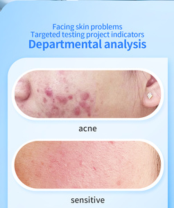 Analyseur de peau du visage complet, appareil de test et de diagnostic cutané - Product Image 5