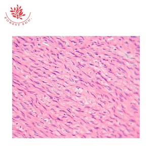 Portaobjetos de microscopio 100 piezas Portaobjetos de histología humana Tipos normales de diapositivas preparadas para biología de educación superior - Product Image 3