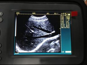 V6 mesin <span class=keywords><strong>Ultrasound</strong></span> portabel hewan peliharaan <span class=keywords><strong>Ultrasound</strong></span> <span class=keywords><strong>Probe</strong></span> <span class=keywords><strong>Linear</strong></span> sapi kuda mesin <span class=keywords><strong>Ultrasound</strong></span> Diagnosis kehamilan <span class=keywords><strong>Ultrasound</strong></span> - Product Image 3