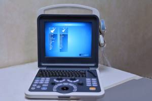 Mesin <span class=keywords><strong>Ultrasound</strong></span> Doppler warna portabel, sistem diagnostik <span class=keywords><strong>Ultrasound</strong></span> warna Digital Doppler untuk manusia - Product Image 3