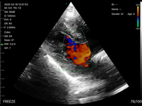 3 en 1 Wifi Función Color Doppler Convex Phased Array Sonda lineal Sistema de diagnóstico de ultrasonido inalámbrico